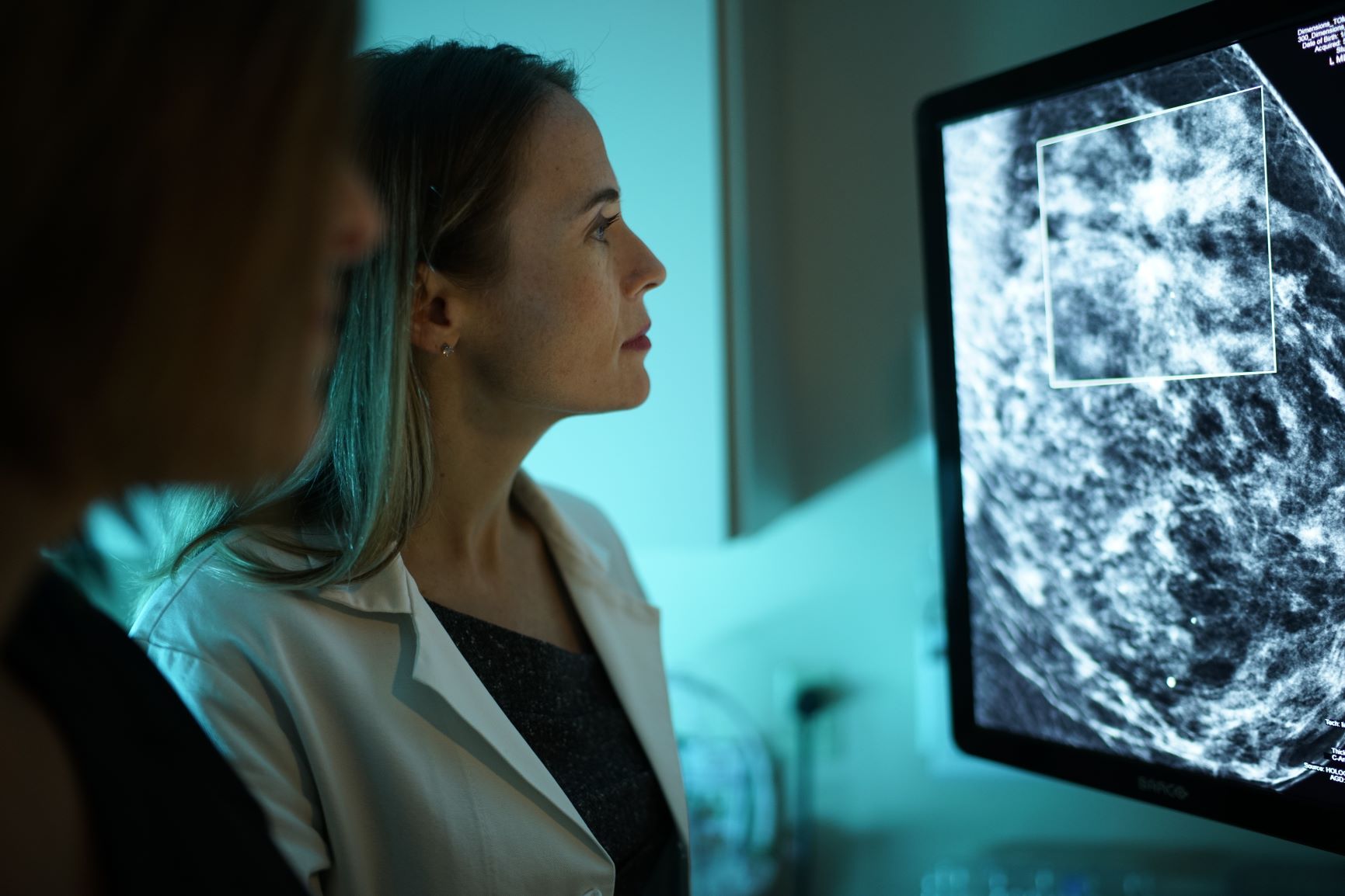 Inspira doctors analyzing a Mammogram