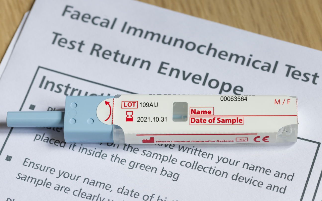 Stool test for bowel cancer screening