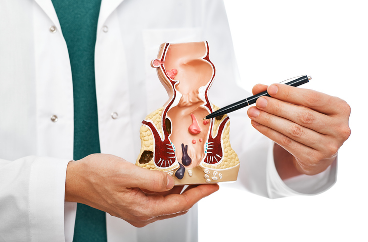 Blood in My Stool? Not Cool. 2 colorectal doctor