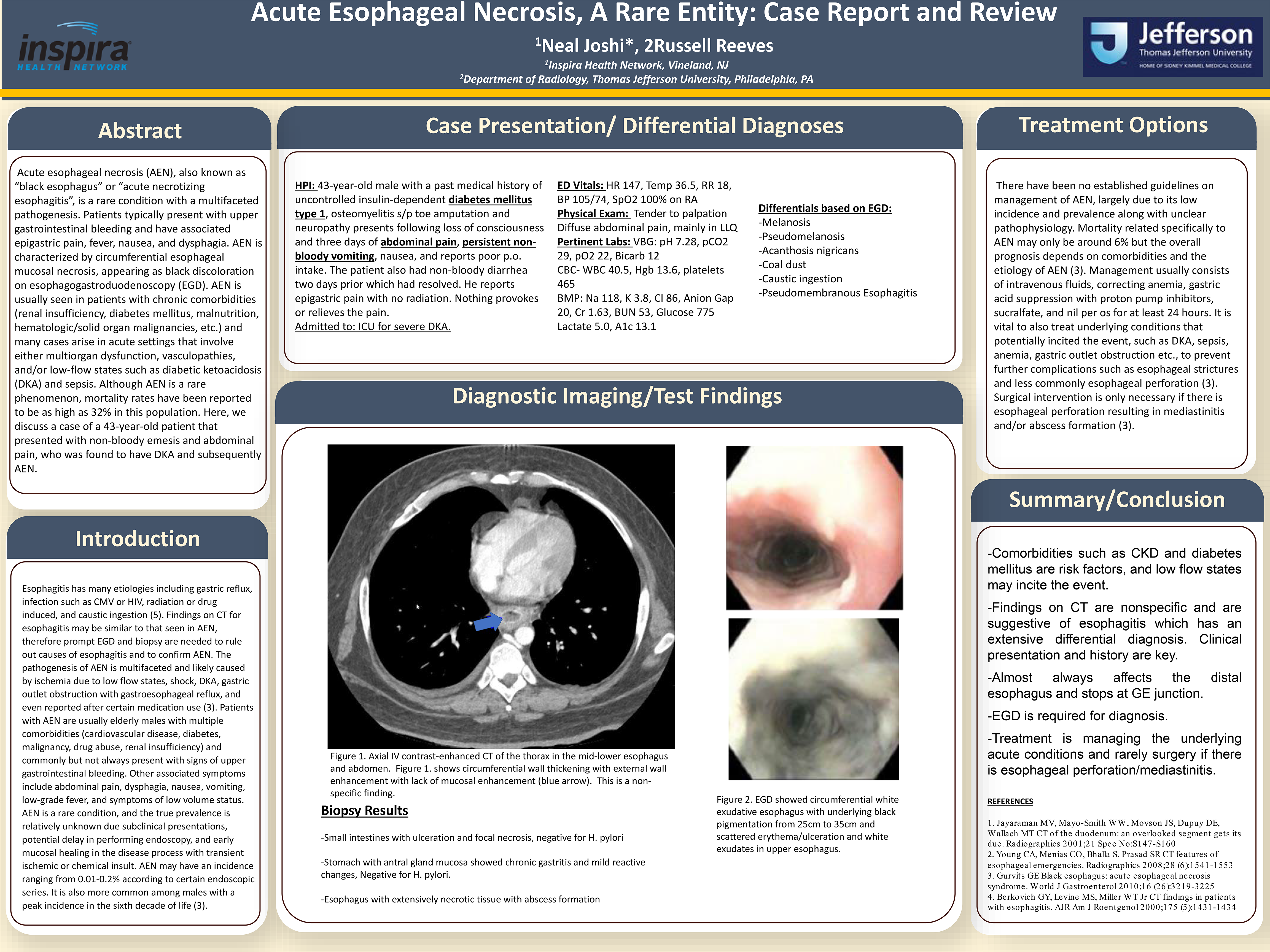 Acute Esophageal Necrosis, A Rare Entity: Case Report and Review