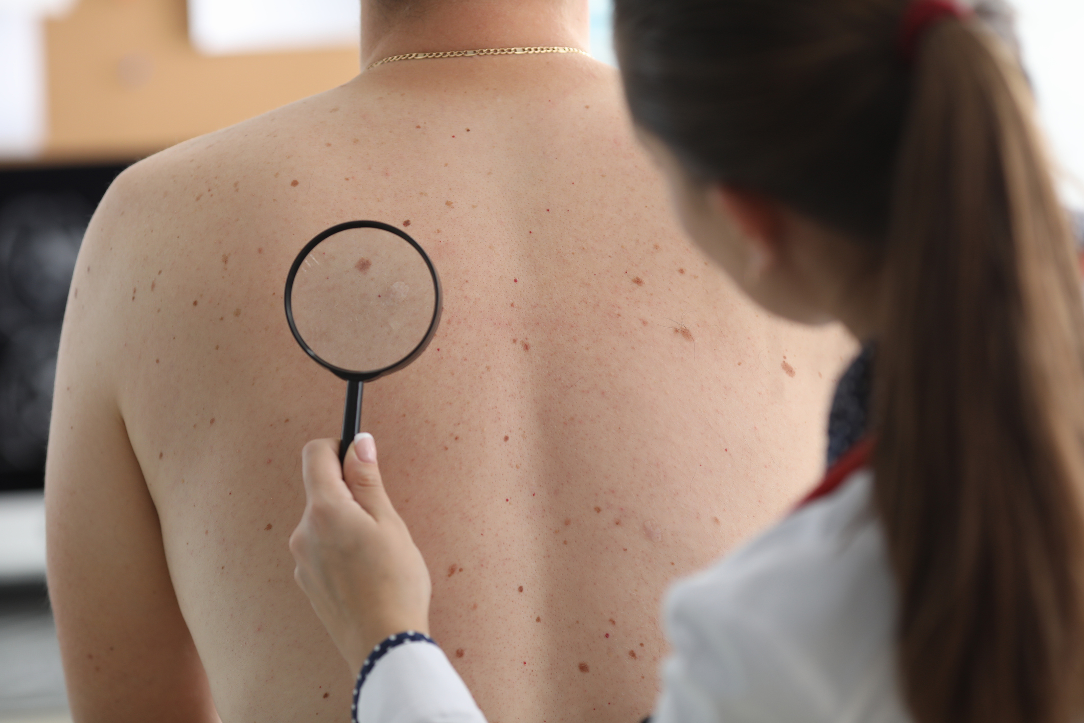 doctor checking patient skin spots