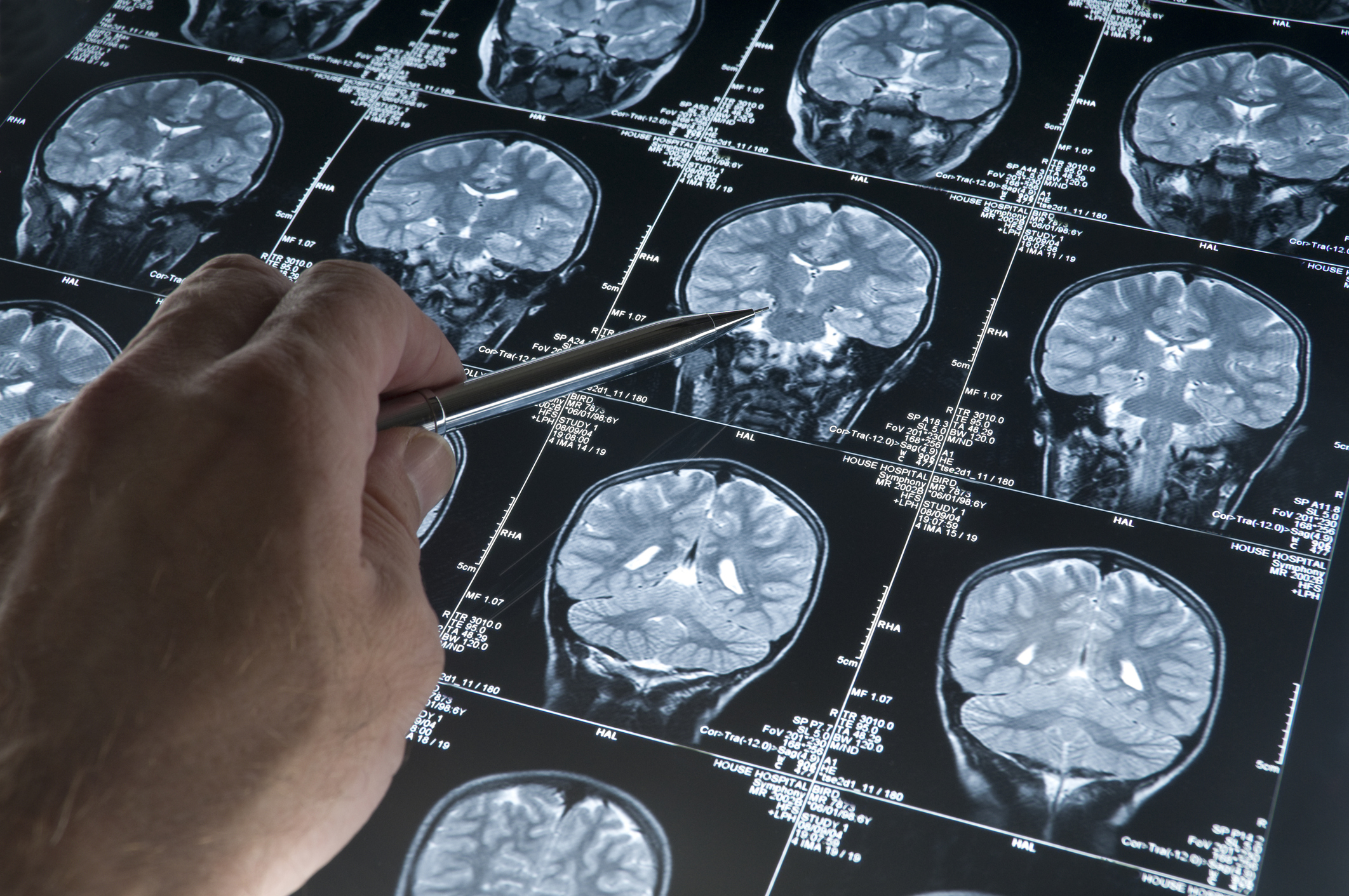 Understanding and Identifying Dementia | Inspira Health