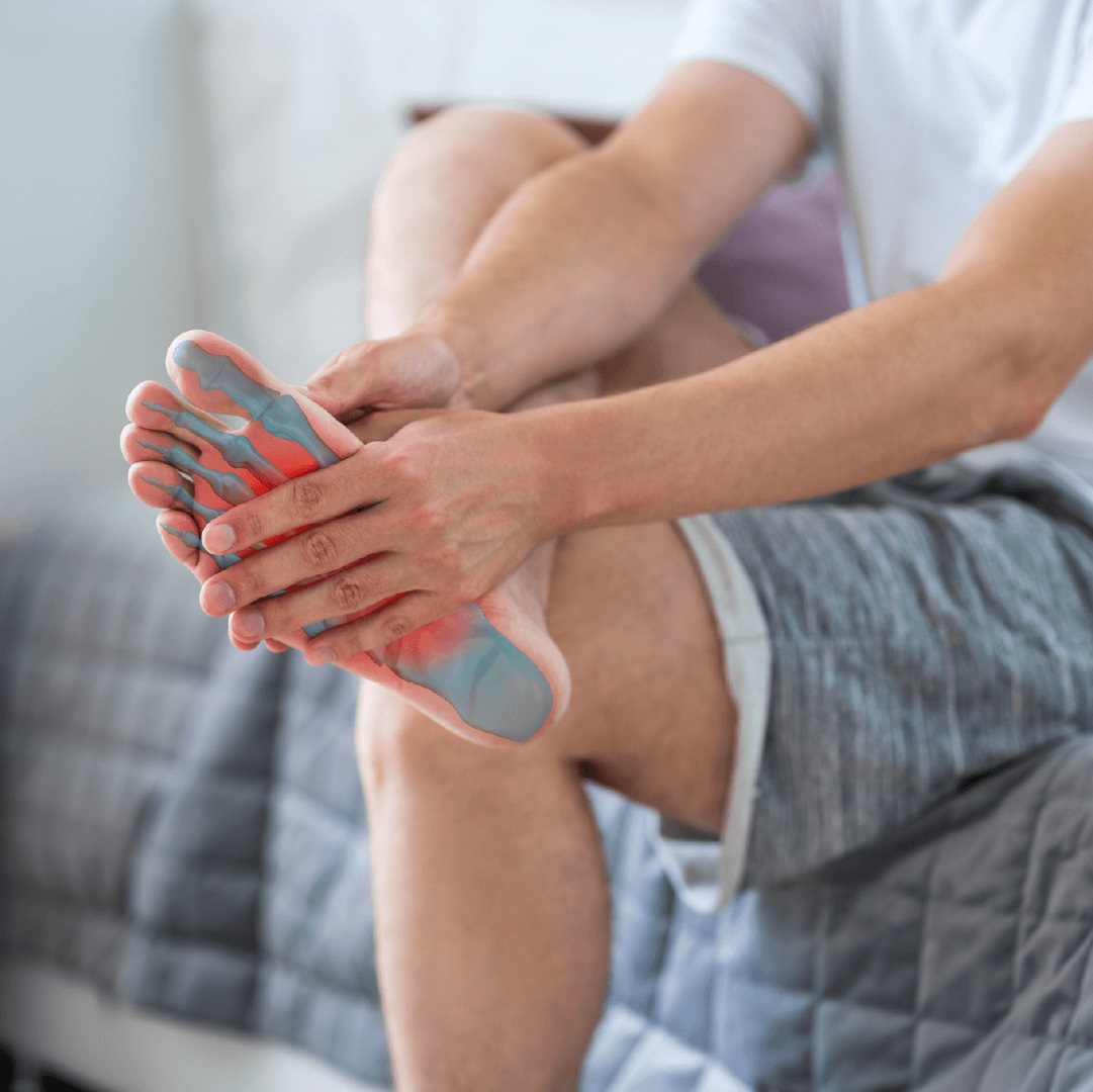 Plantar Fasciitis