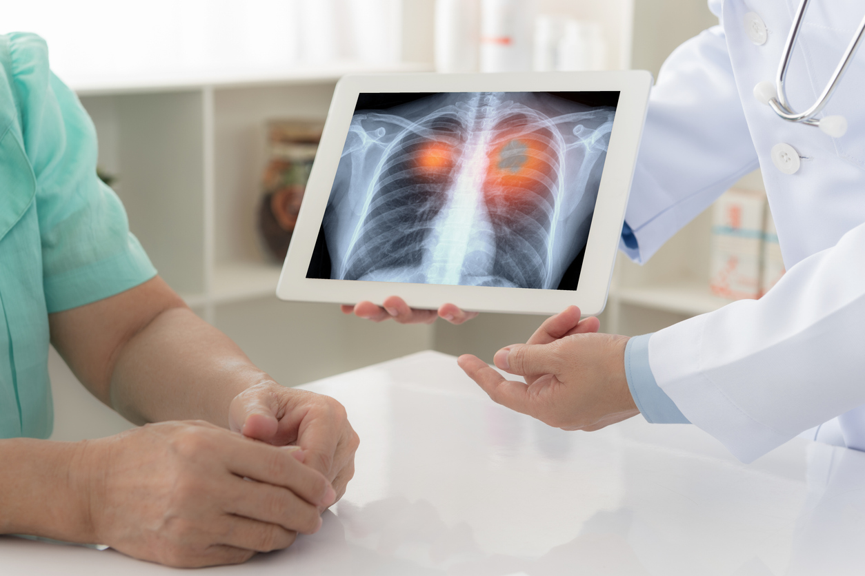 Doctor showing Lung screening report to patient