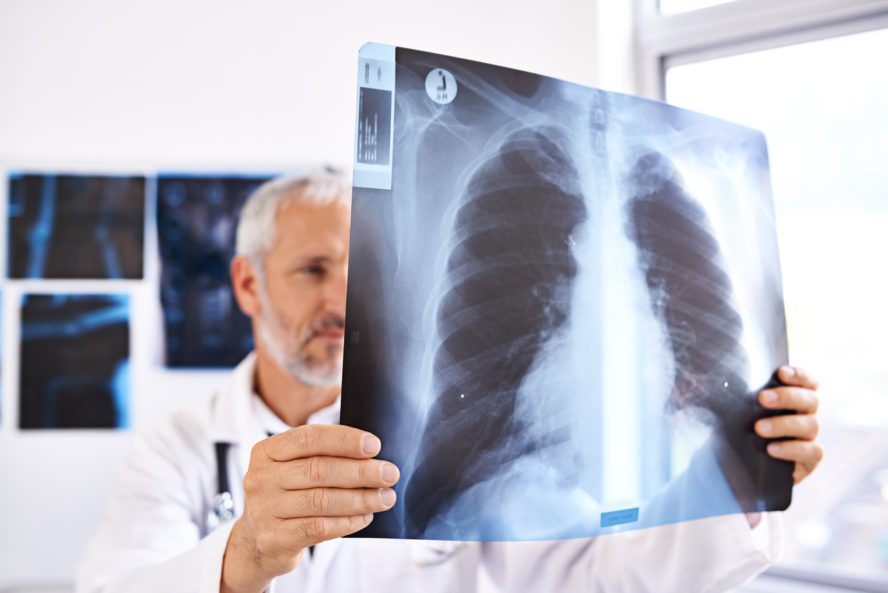 Doctor examining chest x-ray