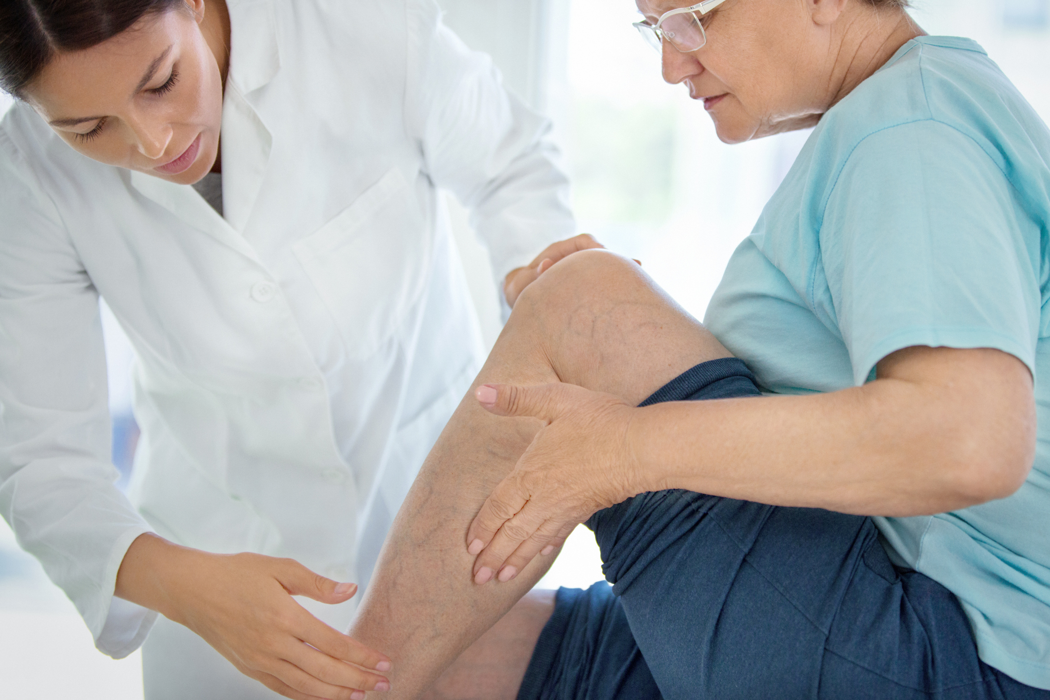 Female doctor examining female patient varicose veins