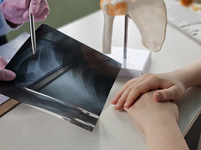 doctor showing x-ray to patient