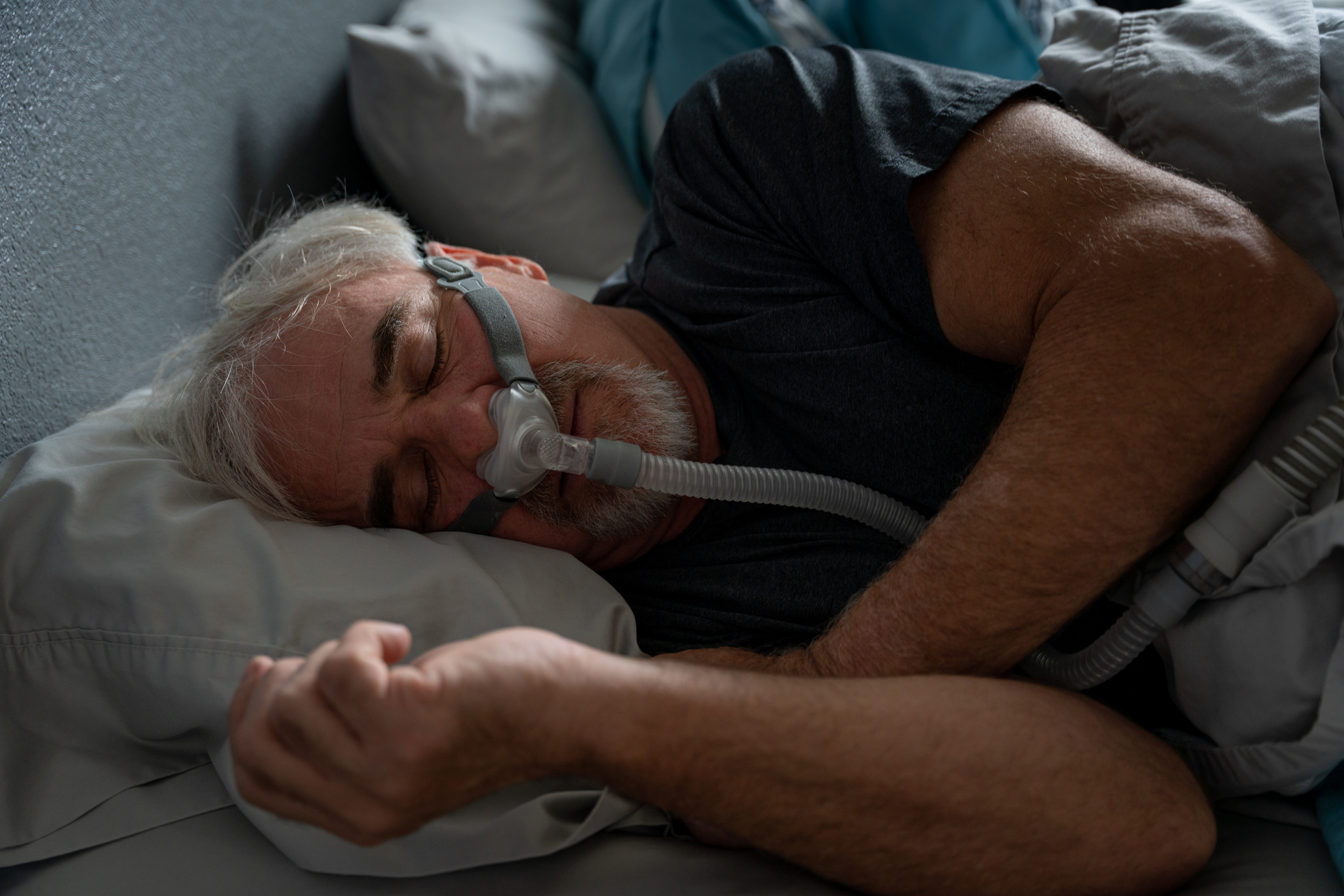 Sleep Apnea