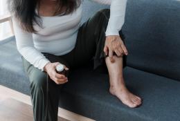 woman scratching her dermatitis feet while sitting on sofa