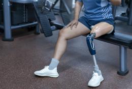 Patient with Limb loss