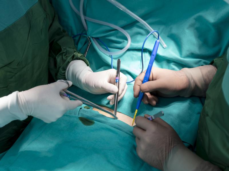 Doctors doing surgery