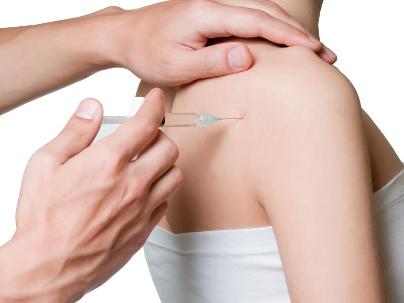 Corticosteroid Injections