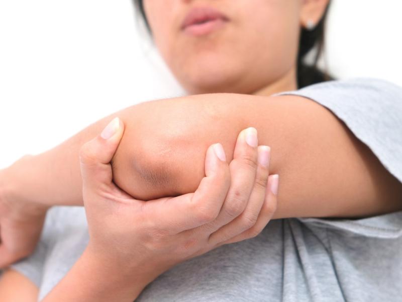 Cubital Tunnel Diagnosed