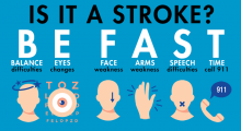 Is it a stroke? BE FAST