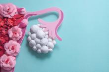 Concept polycystic ovary syndrome, PCOS. Paper art, awareness of PCOS, image of the female reproductive system