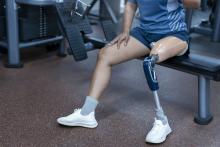 Patient with Limb loss