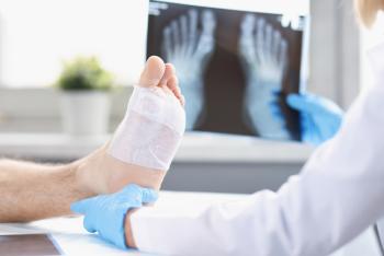 Image of a bandaged foot being examined by a professional  