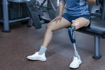 Patient with Limb loss